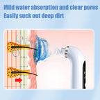 Niki | Facial Pore Cleanser Vacuum - Gentle Blackhead Extraction Tool