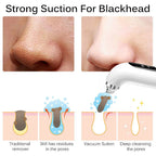 Niki | Facial Pore Cleanser Vacuum - Gentle Blackhead Extraction Tool