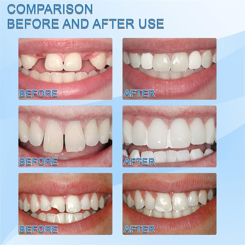 Niki | self tooth repair kit
