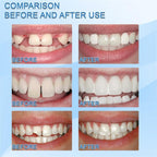 Niki | self tooth repair kit