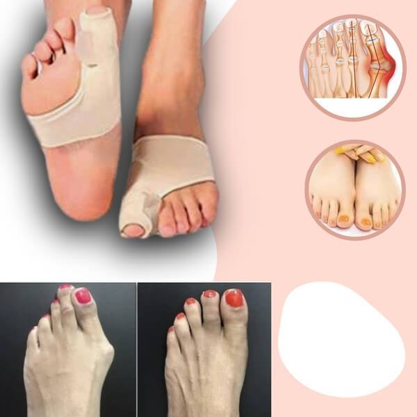 Bunion Corrector for Hallux Valgus Pain Relief