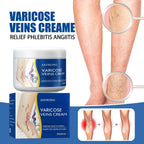 Pain Relief Leg Spider Veins Vasculitis Promote Circulation Smooth Metabolism 30g Exfoliation