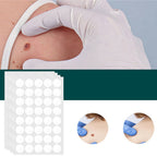 Skin Tag Remover Hydrocolloid Patches