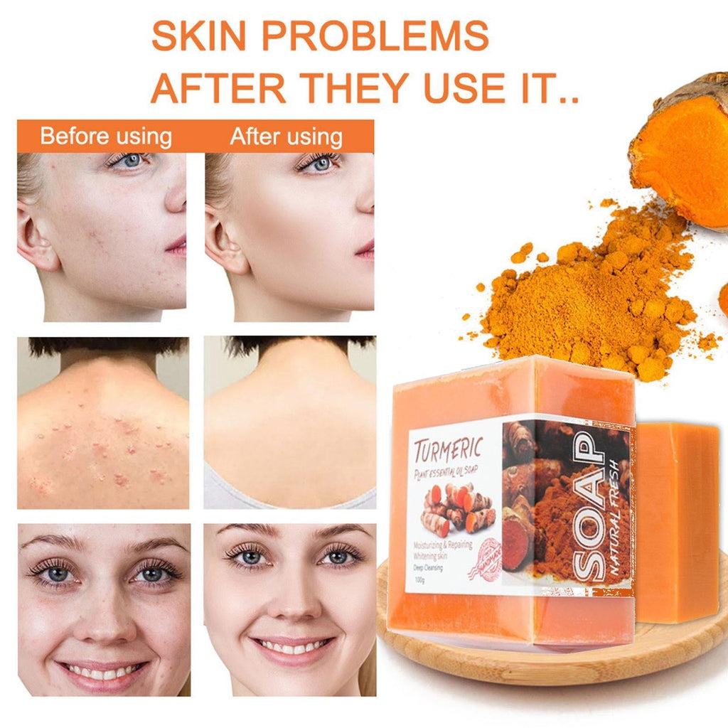 Turmeric Soap (50% off)
